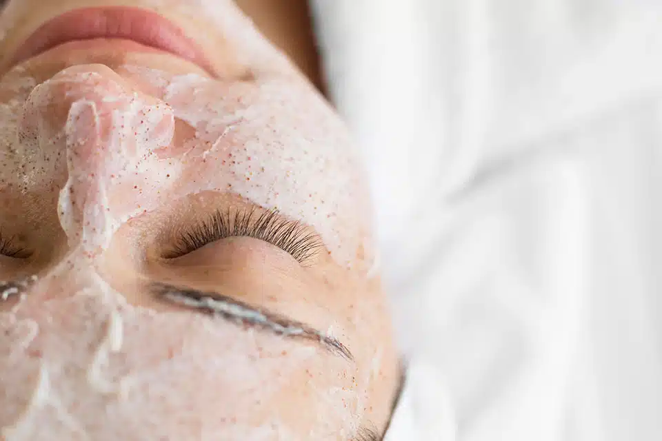 facial anti-acné en Mexicali